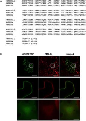 Altered Subcellular Localization of a Tobacco Membrane Raft-Associated Remorin Protein by Tobamovirus Infection and Transient Expression of Viral Replication and Movement Proteins